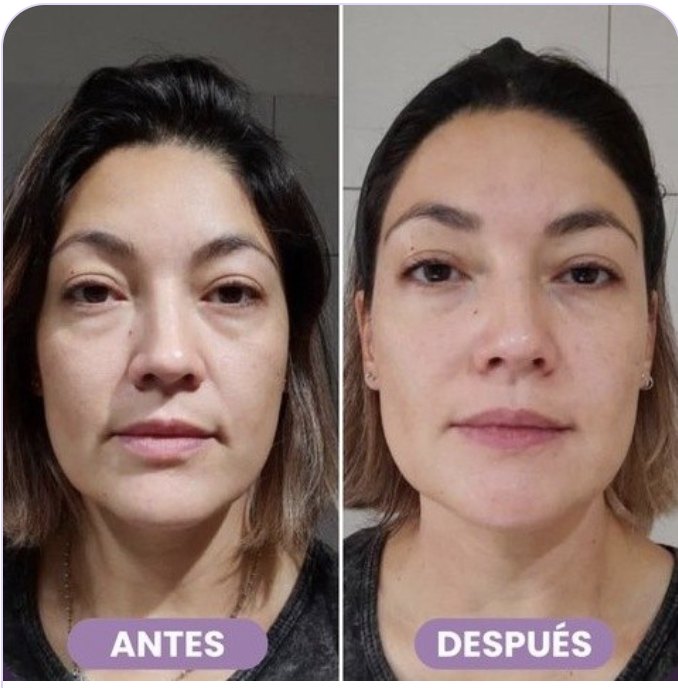 Antes y después de Romina